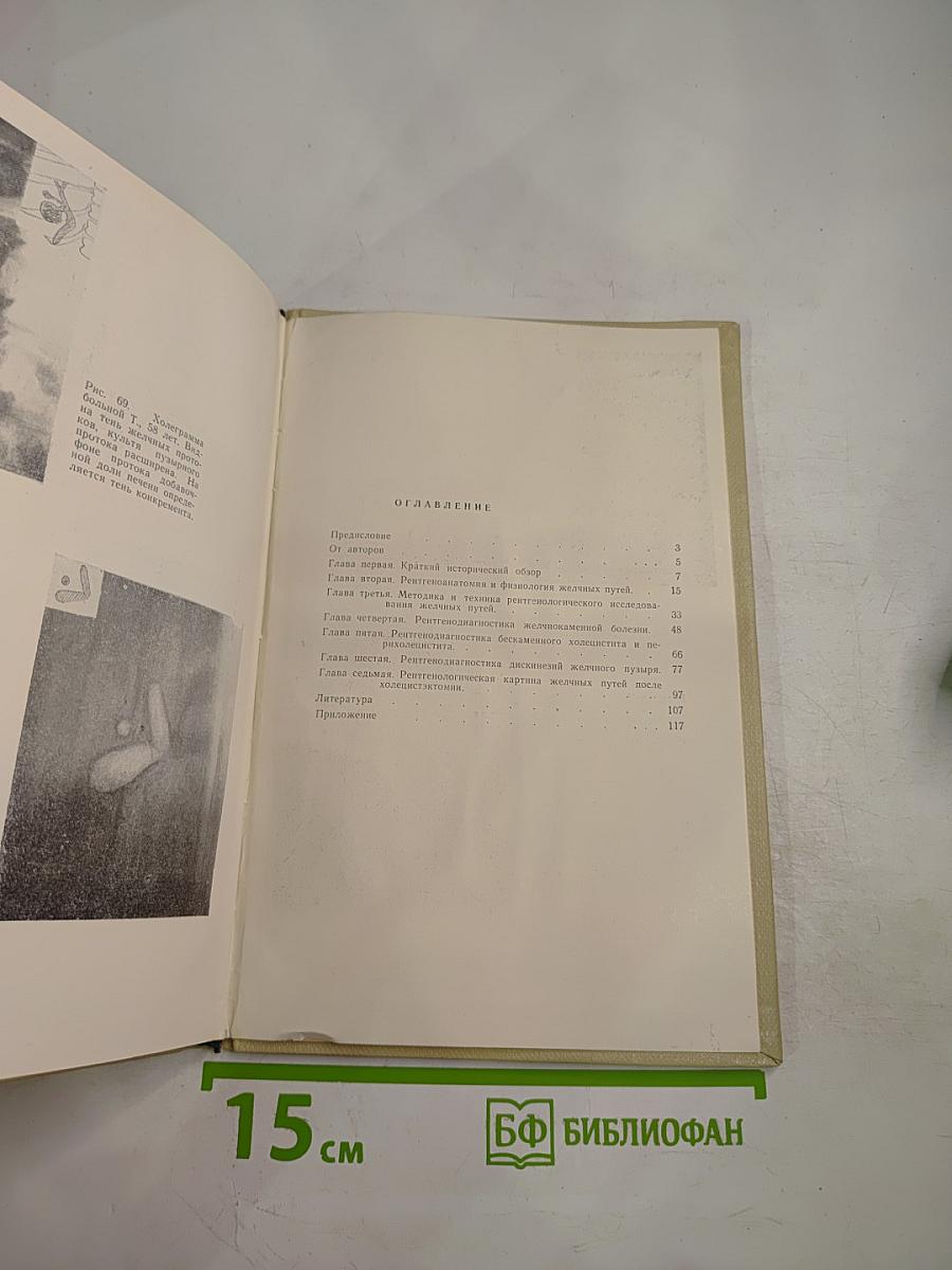 Рентгено-диагностика заболеваний желчных путей