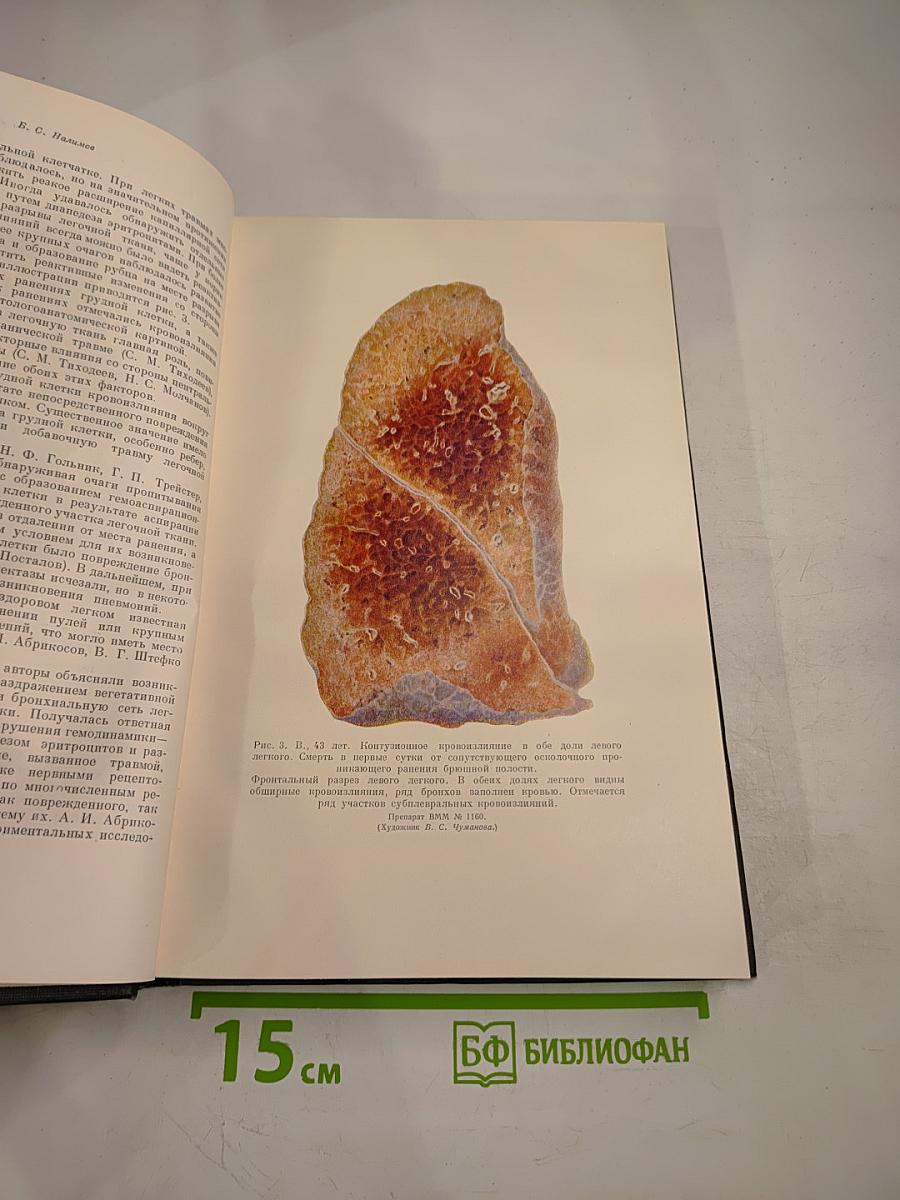 Опыт советской медицины в Великой Отечественной войне 1941-1945 гг. Том 29