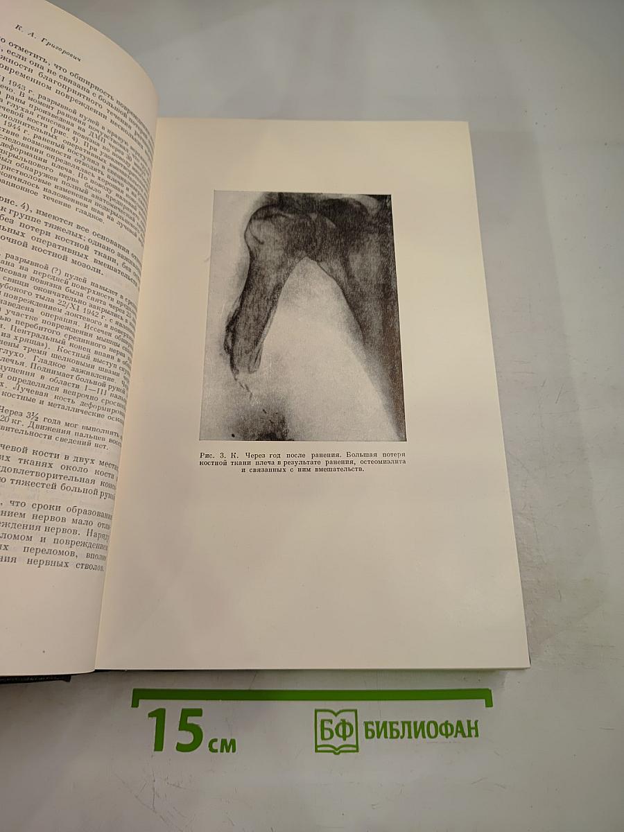 Опыт Советской Медицины в Великой Отечественной Войне 1941-1945 гг. Том 16: Огнестрельные ранения и повреждения конечностей (осложнения)