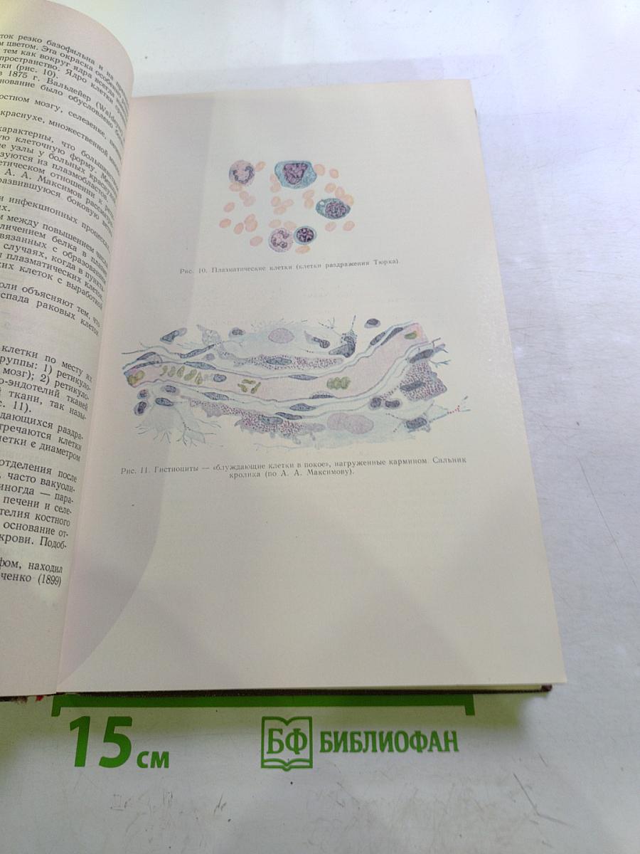 Болезни системы крови