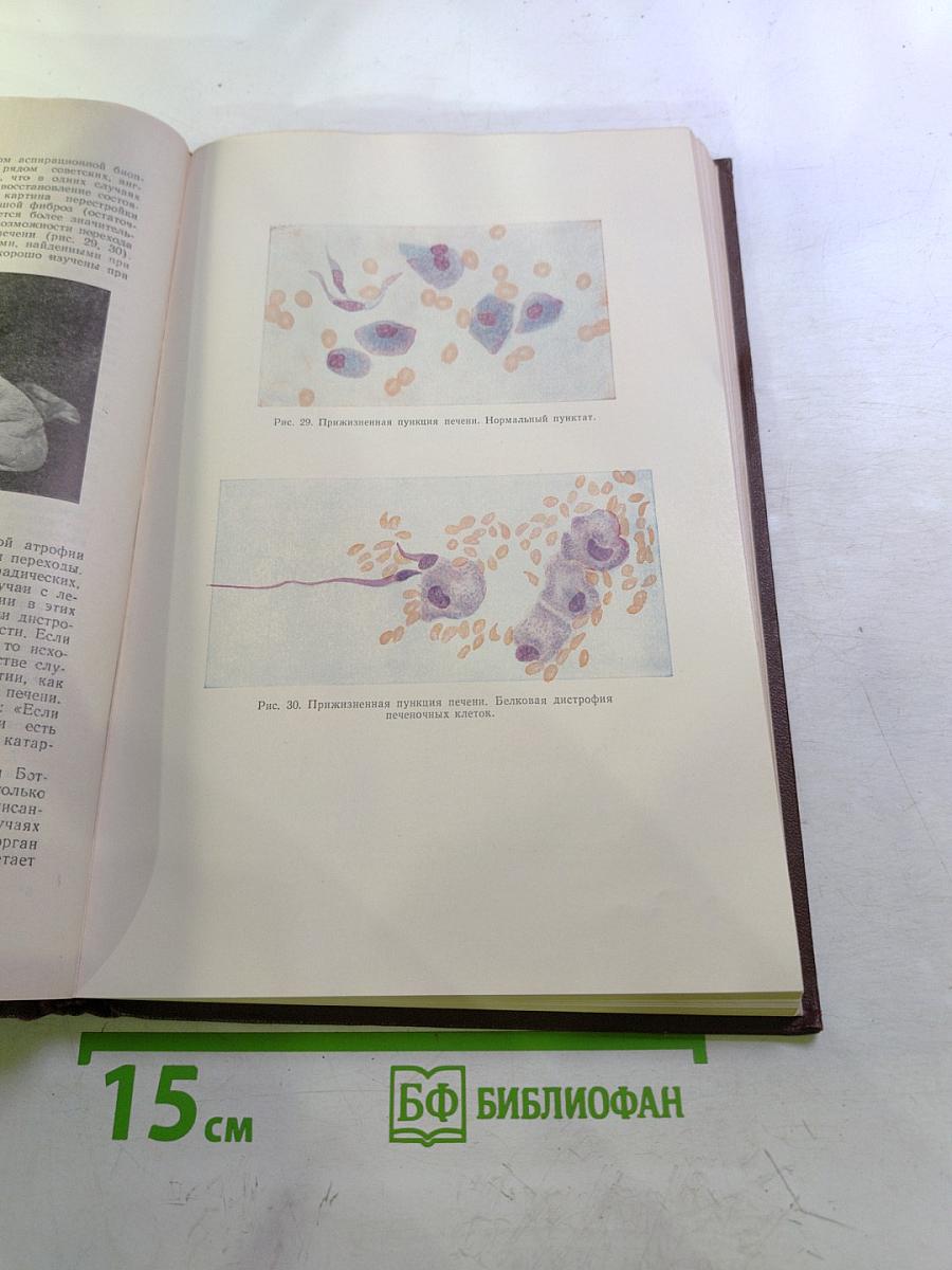 Руководство по внутренним болезням