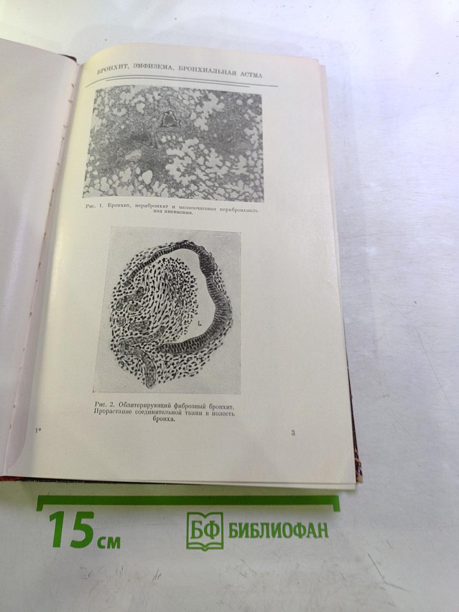 Дифференциальная диагностика заболеваний легких. Том II. Атлас фотоснимков и рентгенограмм