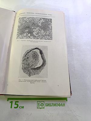 Дифференциальная диагностика заболеваний легких. Том II. Атлас фотоснимков и рентгенограмм