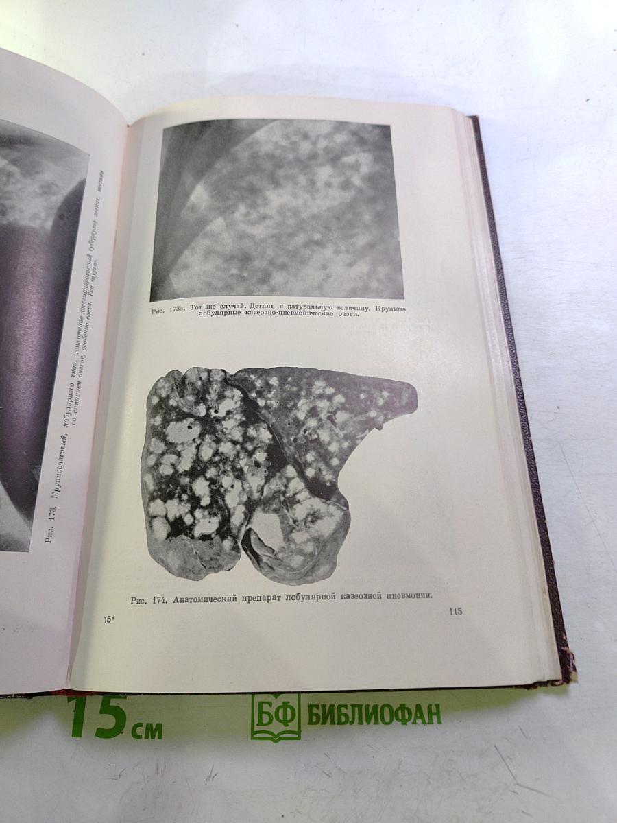 Дифференциальная диагностика заболеваний легких. Том II. Атлас фотоснимков и рентгенограмм