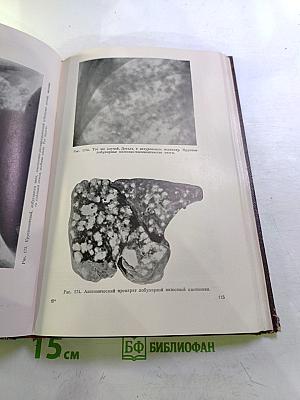 Дифференциальная диагностика заболеваний легких. Том II. Атлас фотоснимков и рентгенограмм