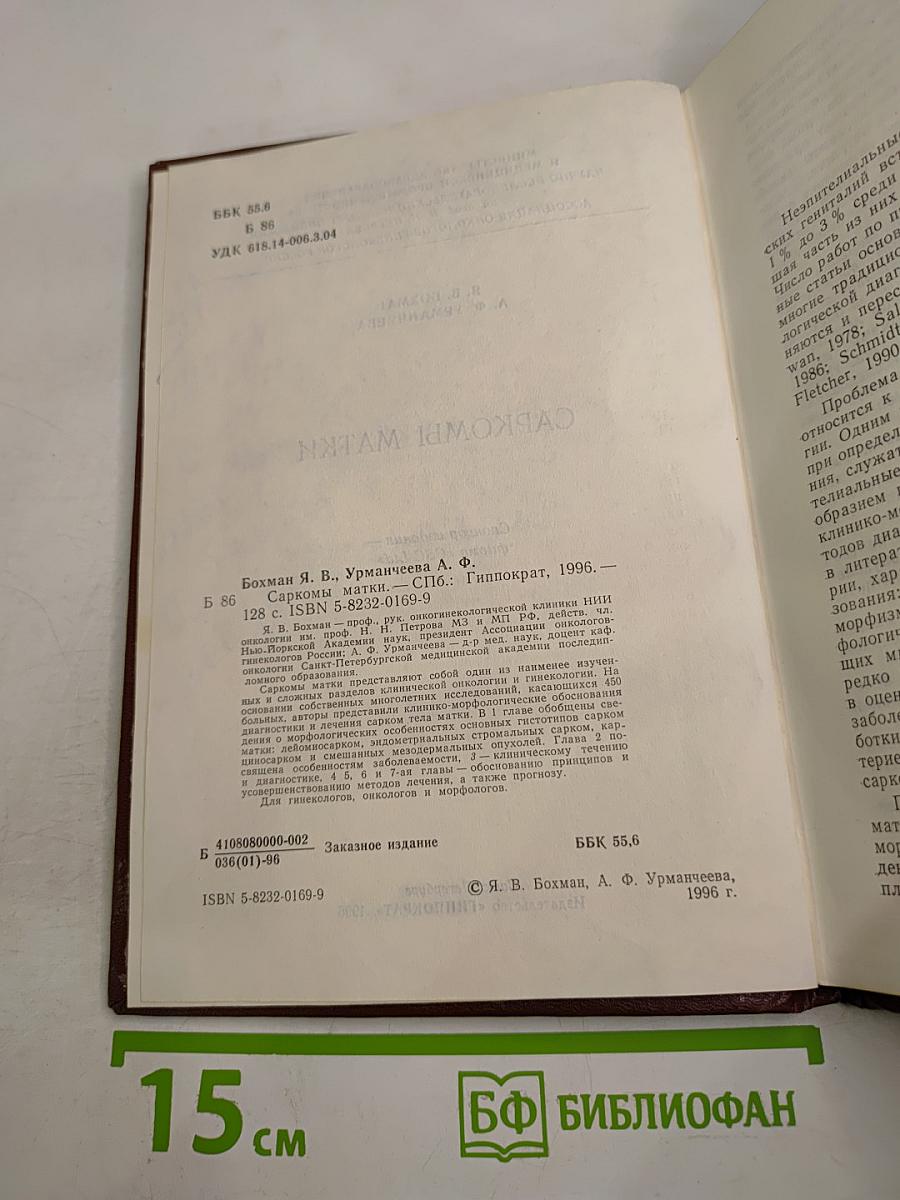 Саркомы матки