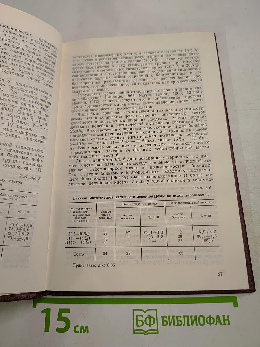 Саркомы матки