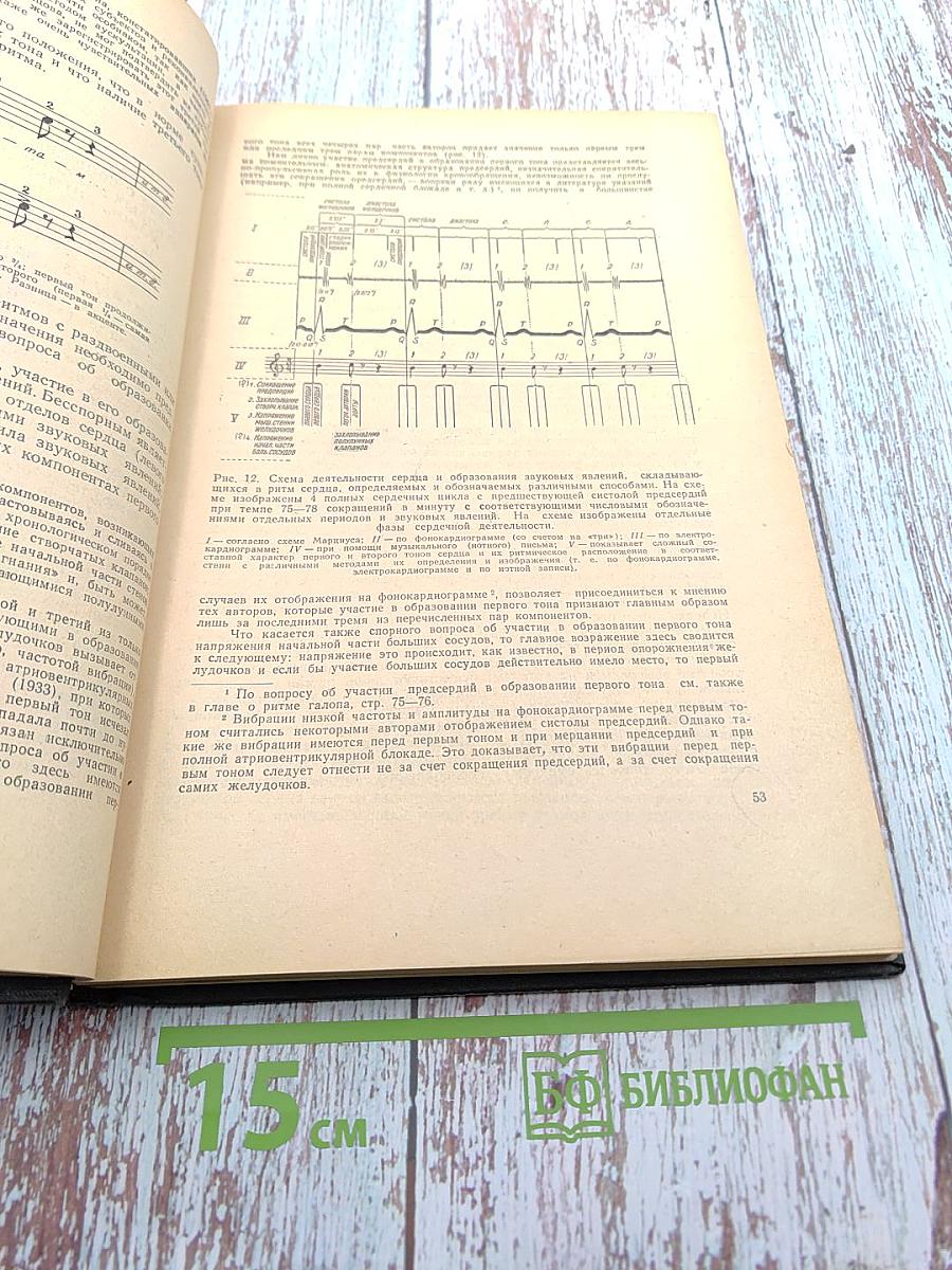 Ритмы сердечной деятельности и их нарушения