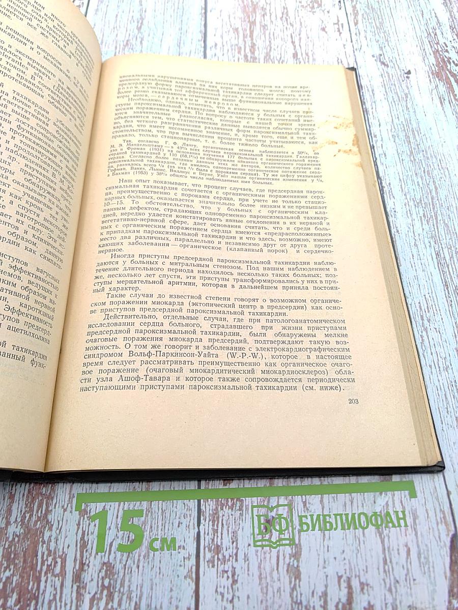 Ритмы сердечной деятельности и их нарушения