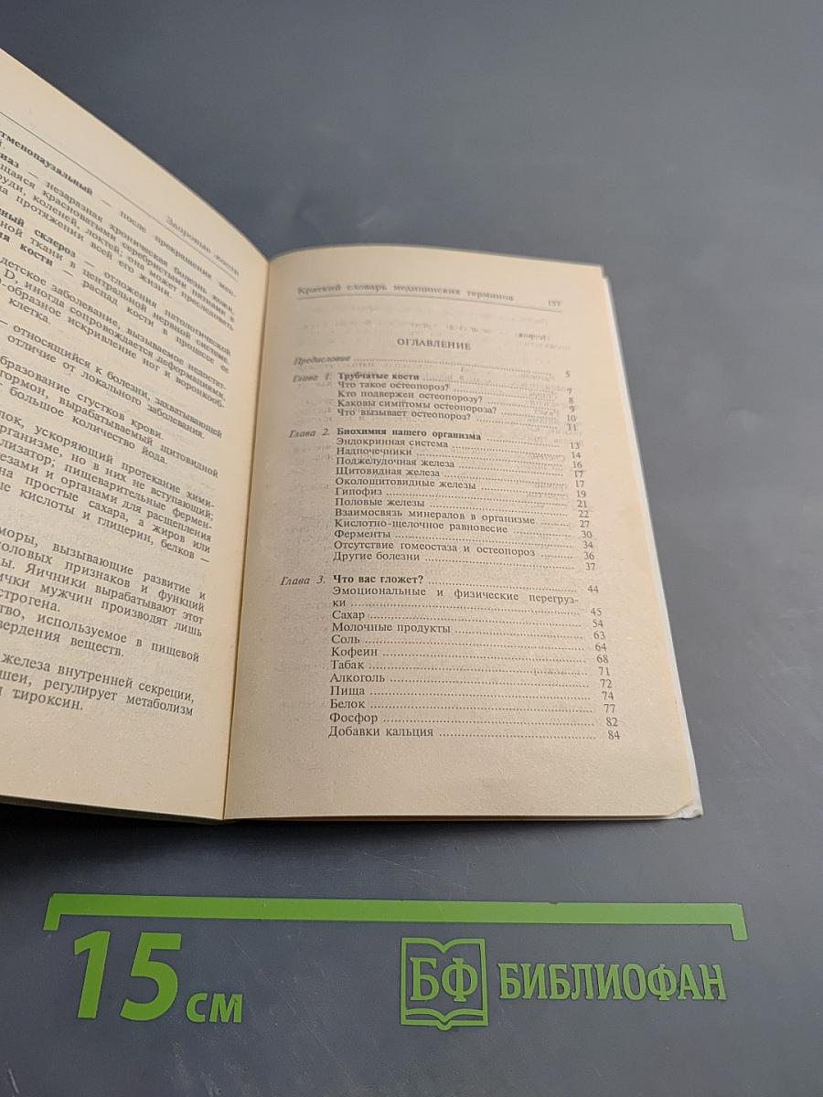 Здоровые кости Что необходимо знать об остеопорозе