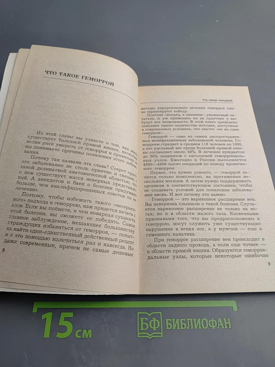 Геморрой. варикозное расширение вен