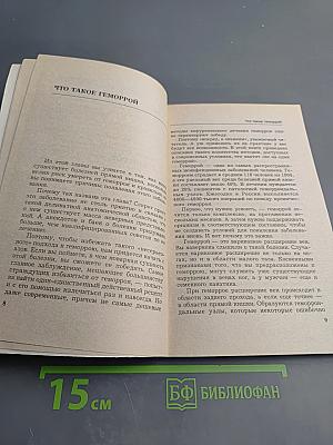 Геморрой. варикозное расширение вен