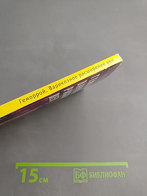 Геморрой. варикозное расширение вен