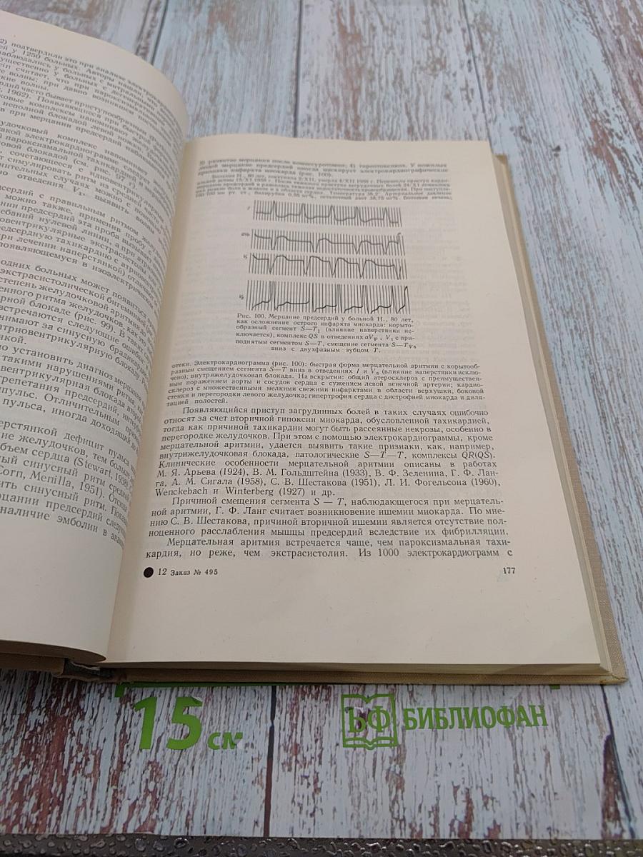 Электрокардиографическая диагностика