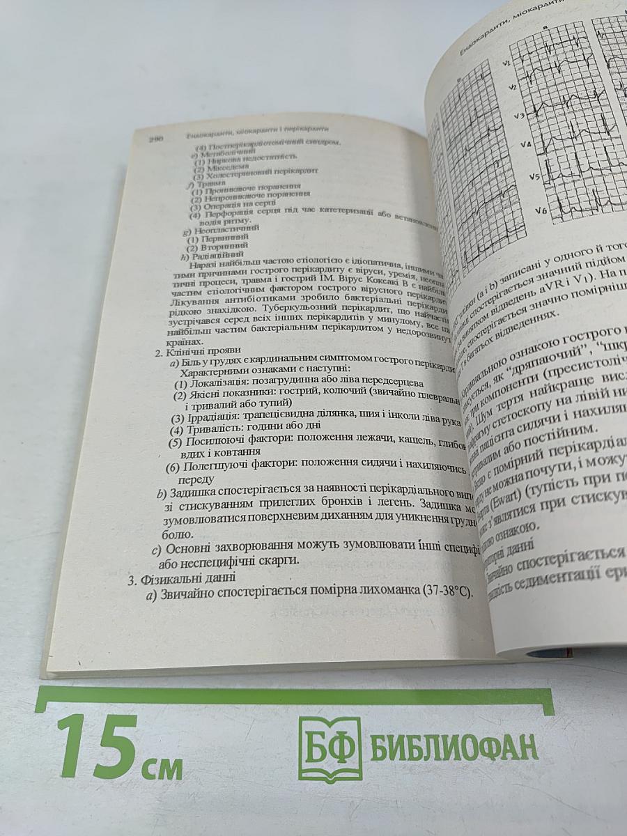 Невідкладні стани в кардіології