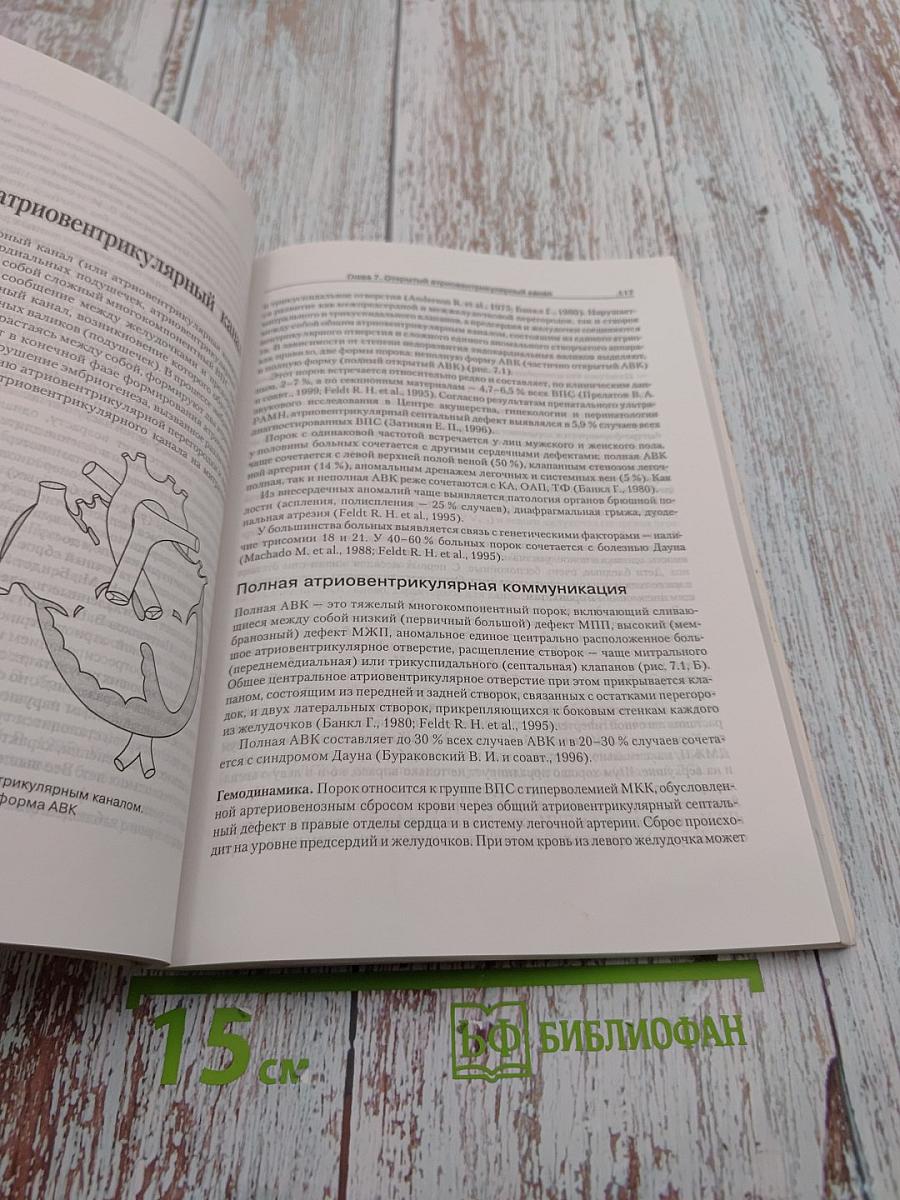 Врожденные пороки сердца у детей