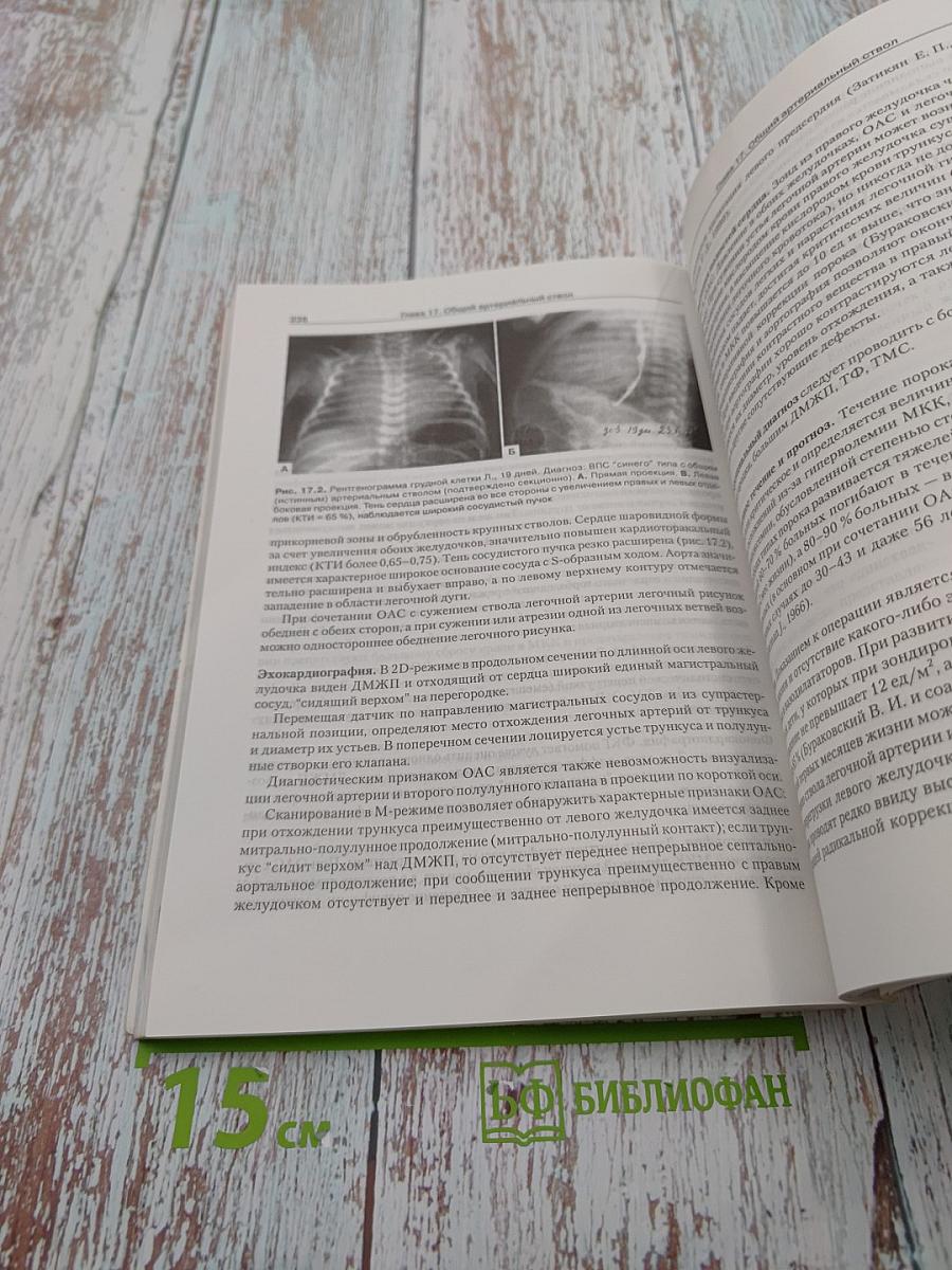 Врожденные пороки сердца у детей