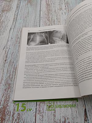 Врожденные пороки сердца у детей