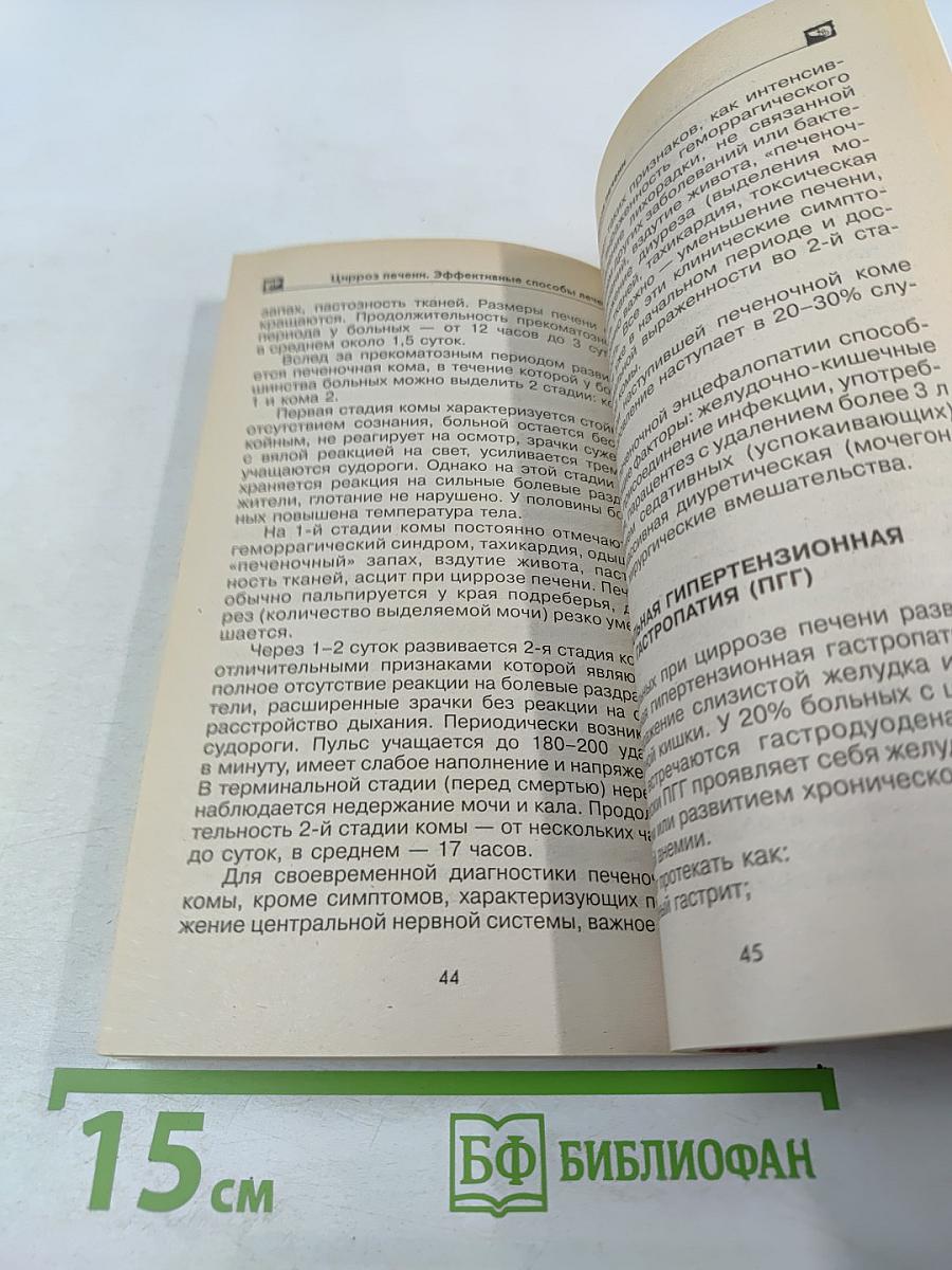 Цирроз печени. Эффективные способы лечения