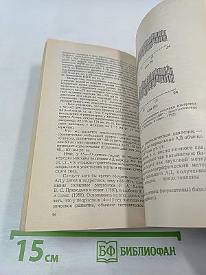 Гипертоническая болезнь (эссенциальная гипертензия)