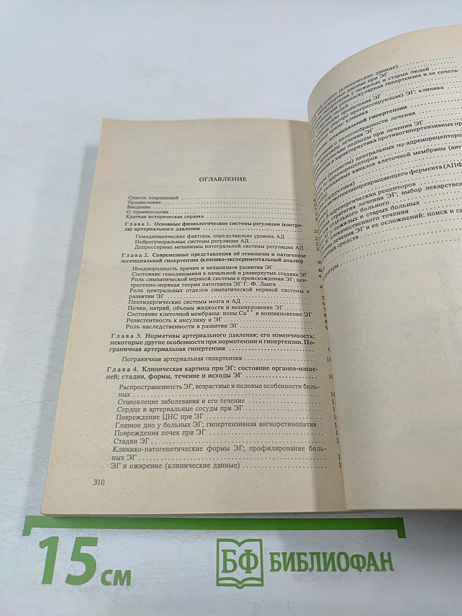 Гипертоническая болезнь (эссенциальная гипертензия)