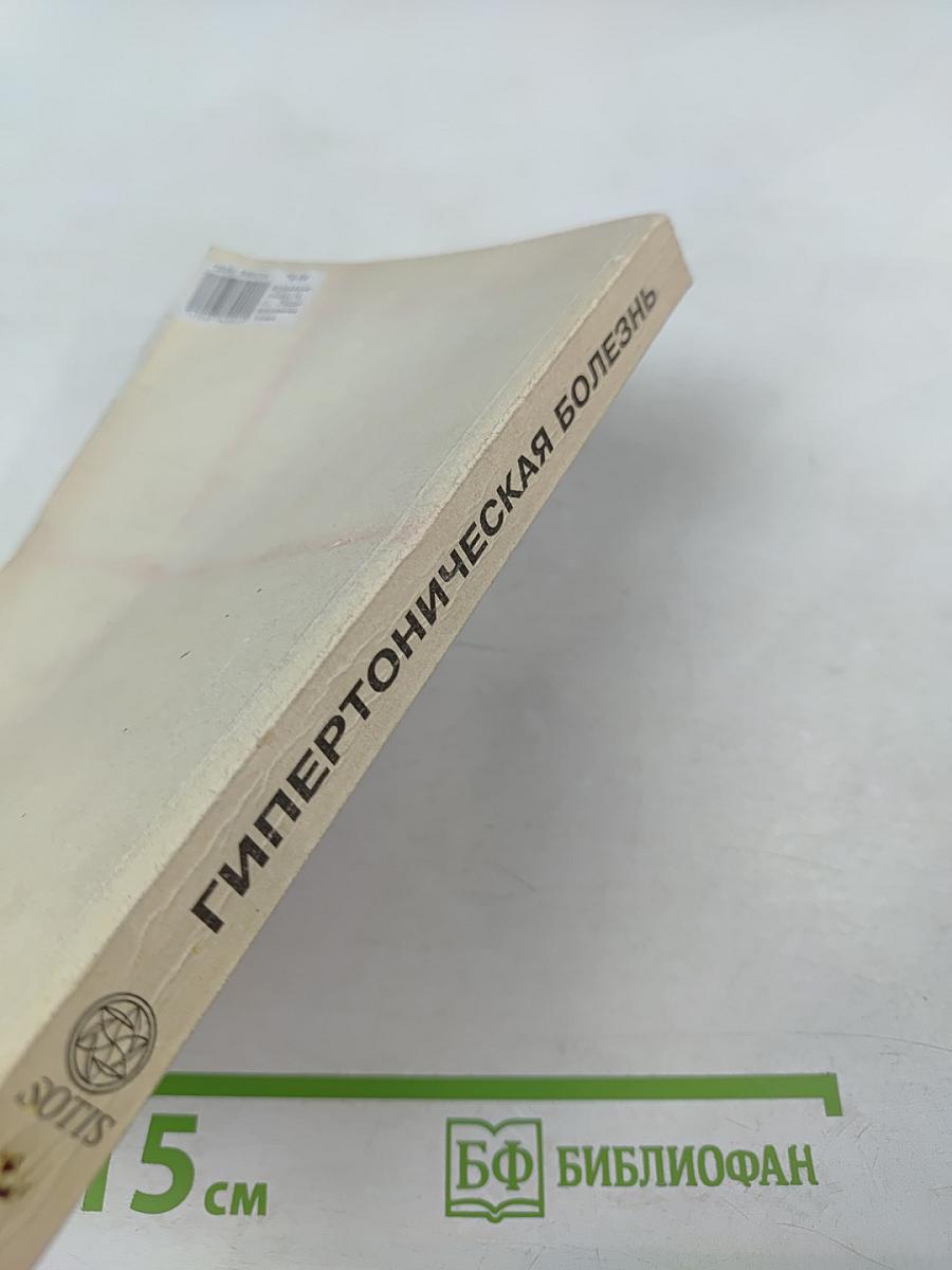 Гипертоническая болезнь (эссенциальная гипертензия)