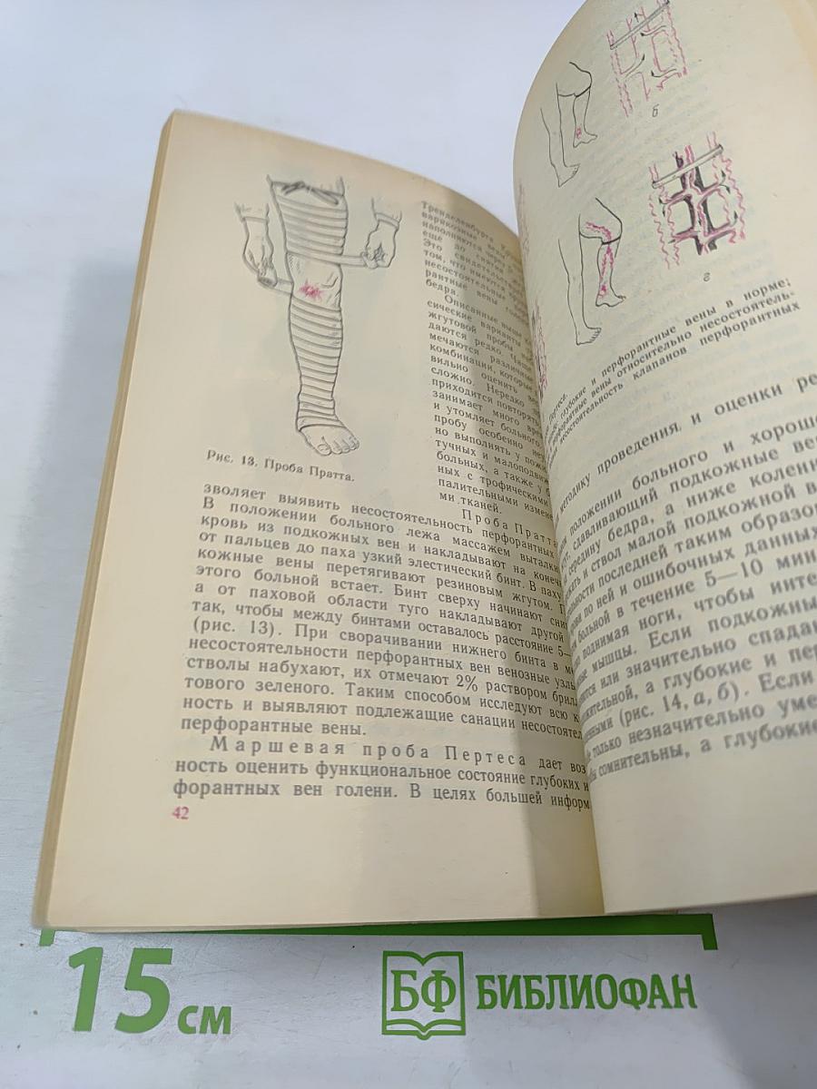 Болезни вен и лимфатической системы конечностей