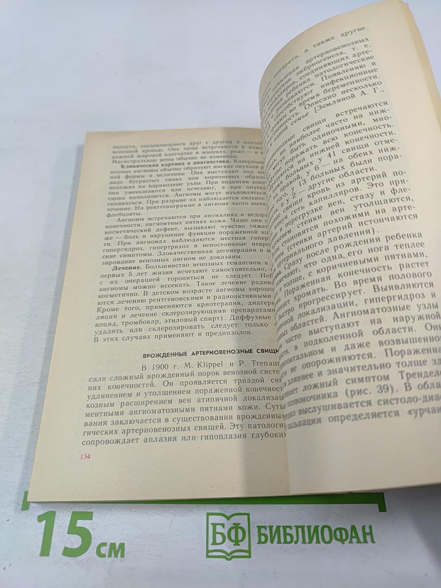 Болезни вен и лимфатической системы конечностей