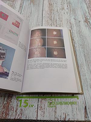 Глаукома при псевдонормальном давлении