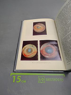 Герпес. Этиология, диагностика, лечение