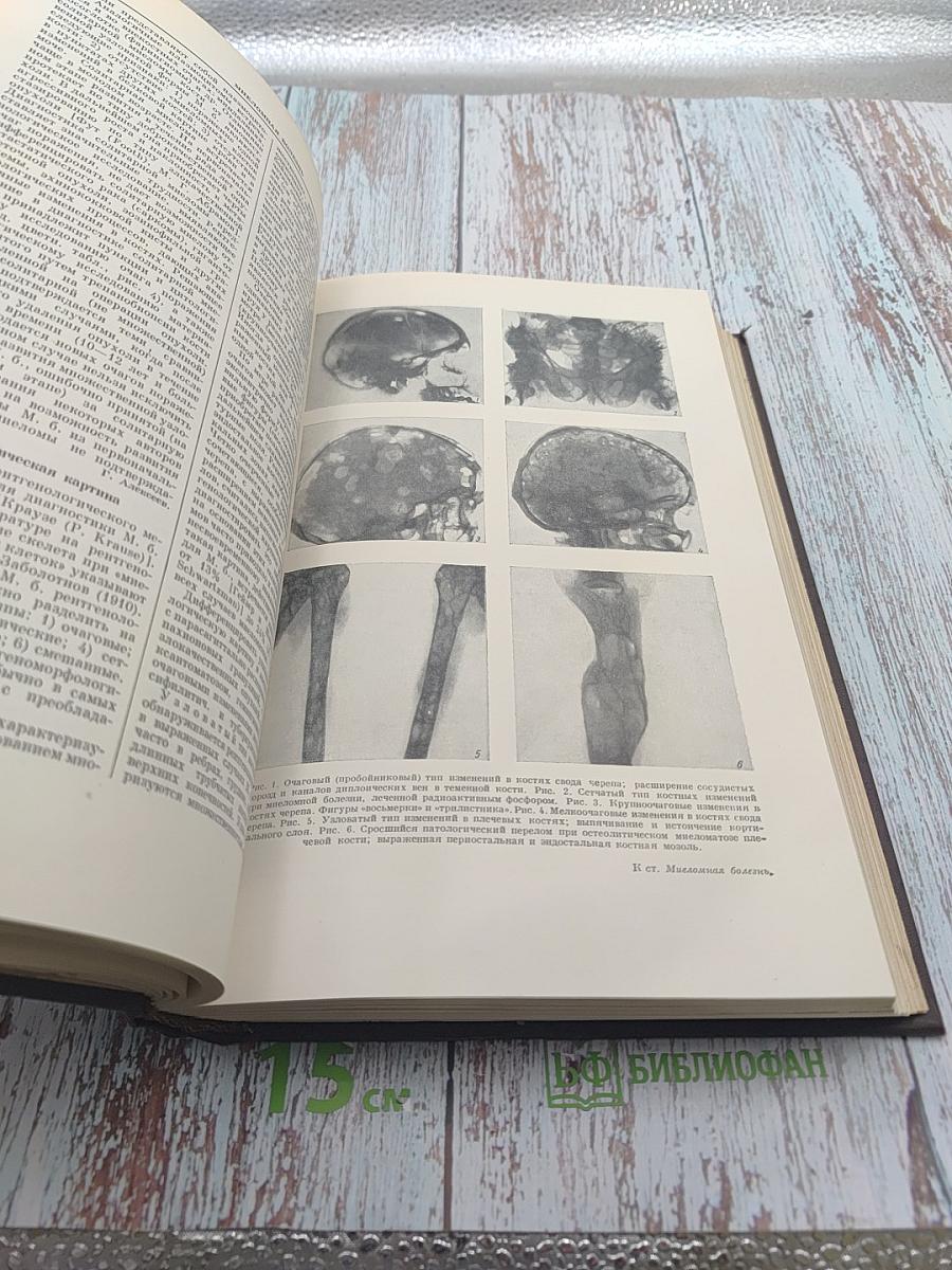 Большая медицинская энциклопедия. Том 18: Мерсалиа - Моносахариды