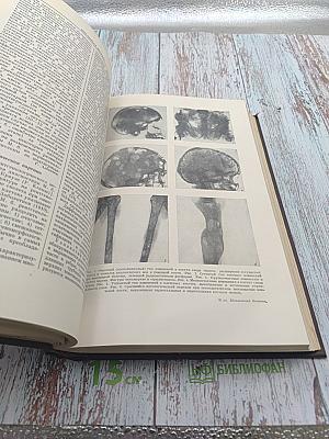 Большая медицинская энциклопедия. Том 18: Мерсалиа - Моносахариды