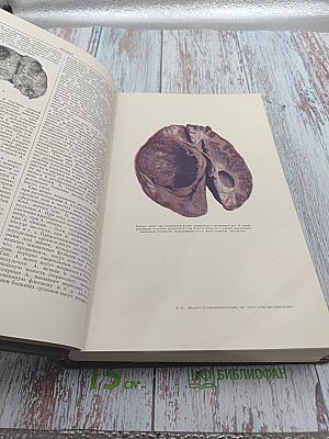 Большая Медицинская Энциклопедия. Том 1 - А-Ангиофиброма