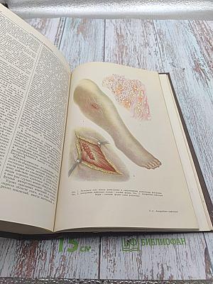 Большая Медицинская Энциклопедия. Том 1 - А-Ангиофиброма