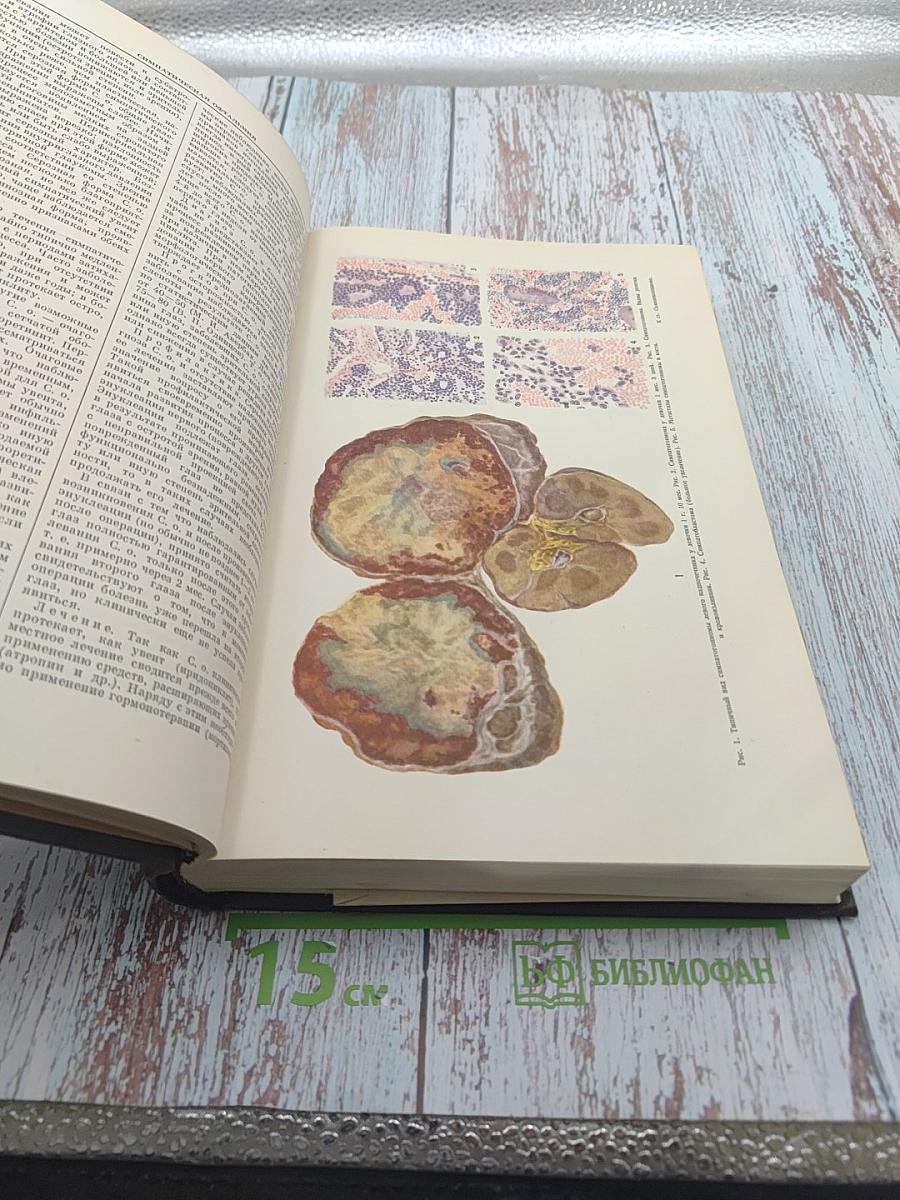 Большая медицинская энциклопедия, Том 30