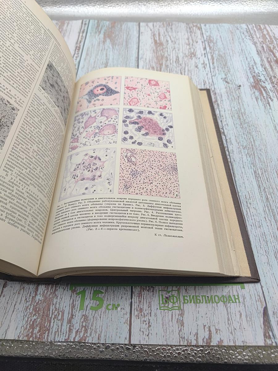 Большая Медицинская Энциклопедия. Том 25: Плотность - Пороцефалез