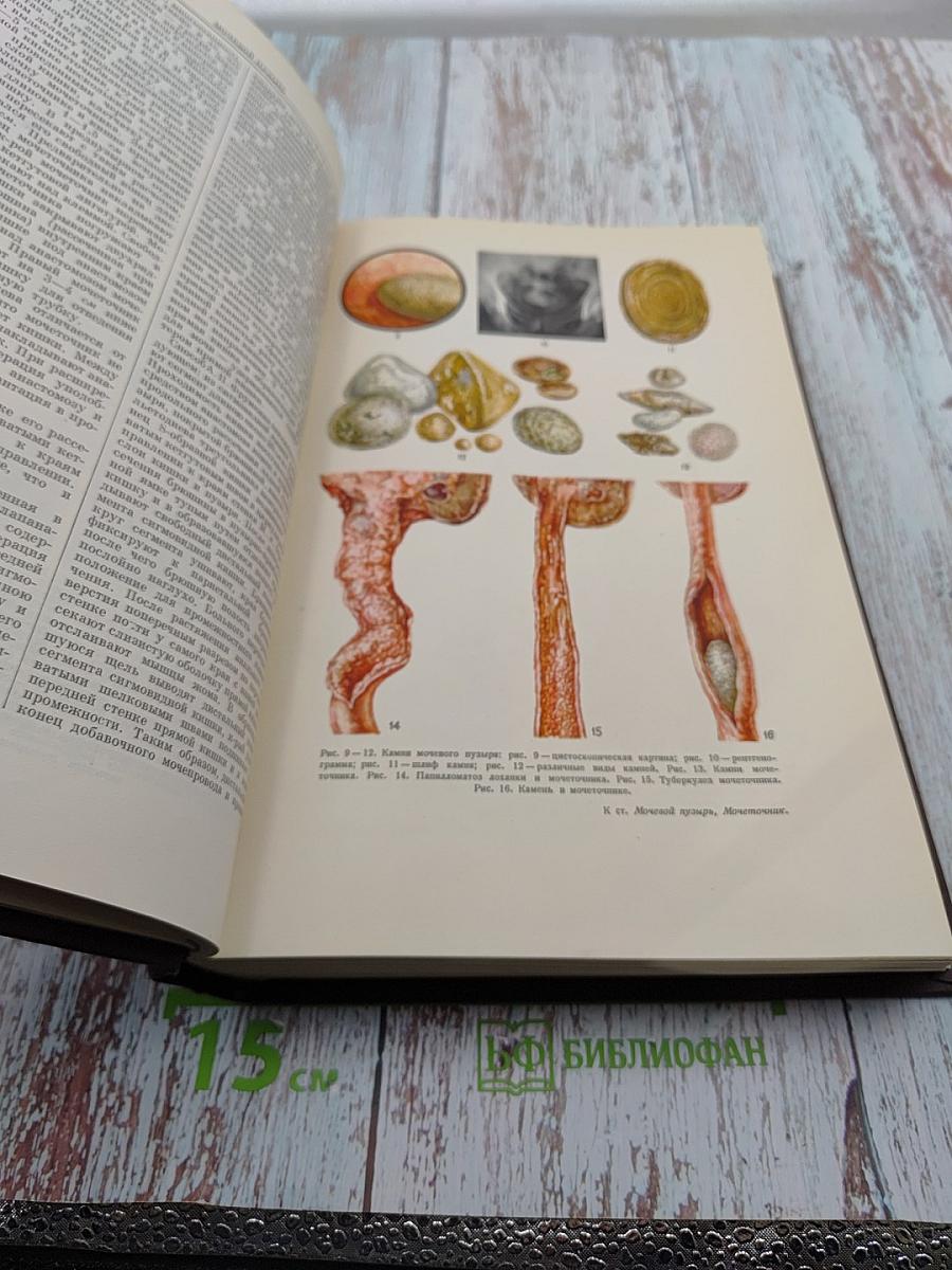 Большая медицинская энциклопедия. Том 19: Монофагия-Наталоин