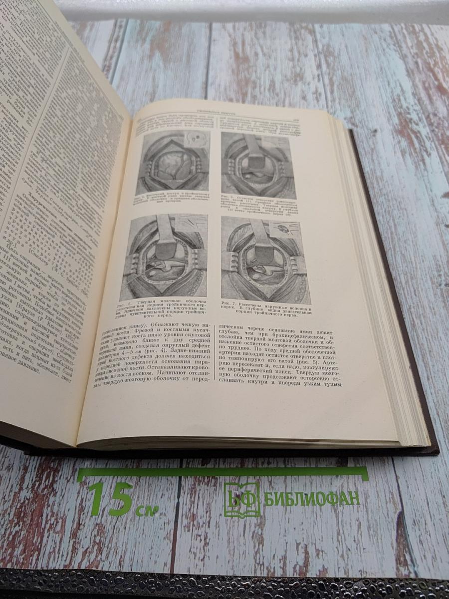 Большая медицинская энциклопедия. Том 32. Тениидозы – Туляремия