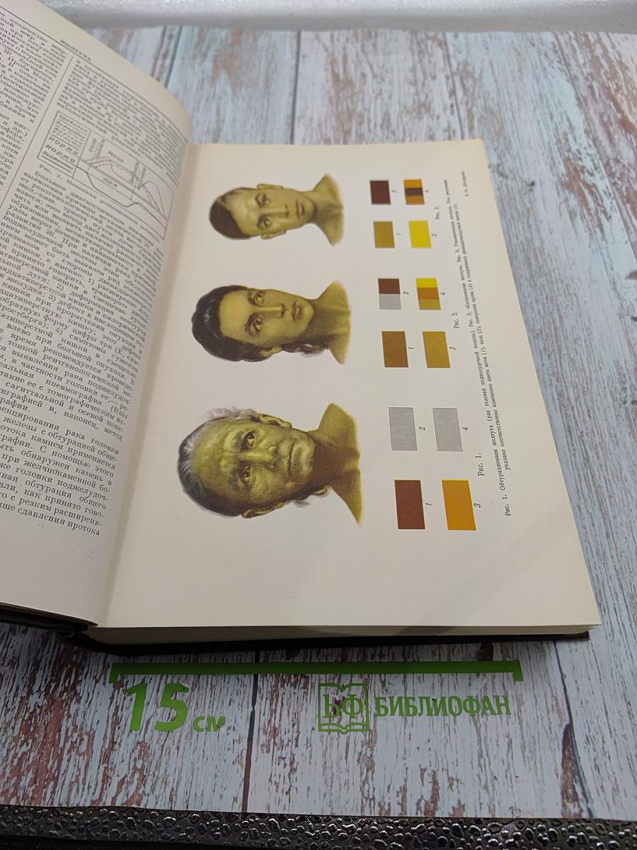 Большая медицинская энциклопедия. Том 10: Желтуха - Иващенцов