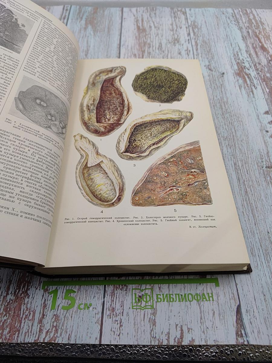 Большая медицинская энциклопедия. Том 34: Хлорофиллы - Экскохлеация