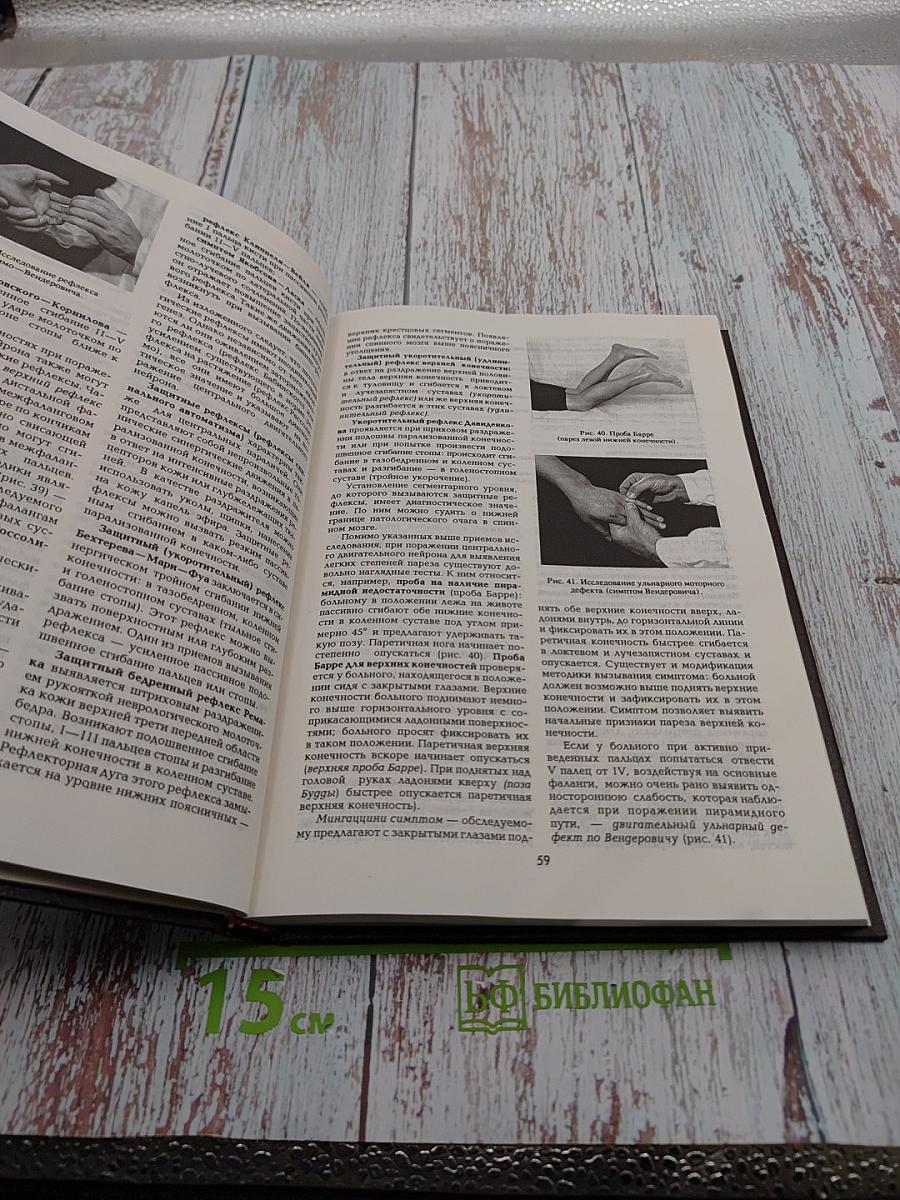 Топическая диагностика заболеваний нервной системы