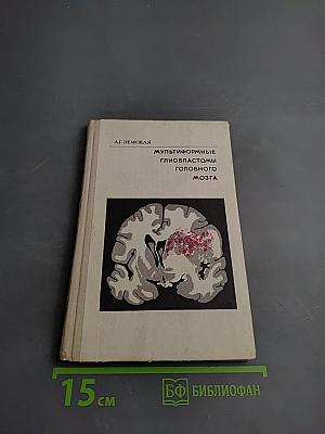 Мультиформные глиобластомы головного мозга