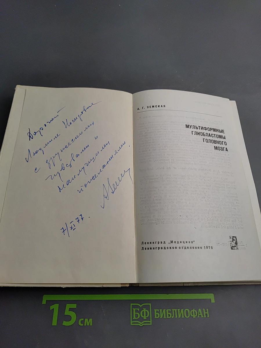 Мультиформные глиобластомы головного мозга