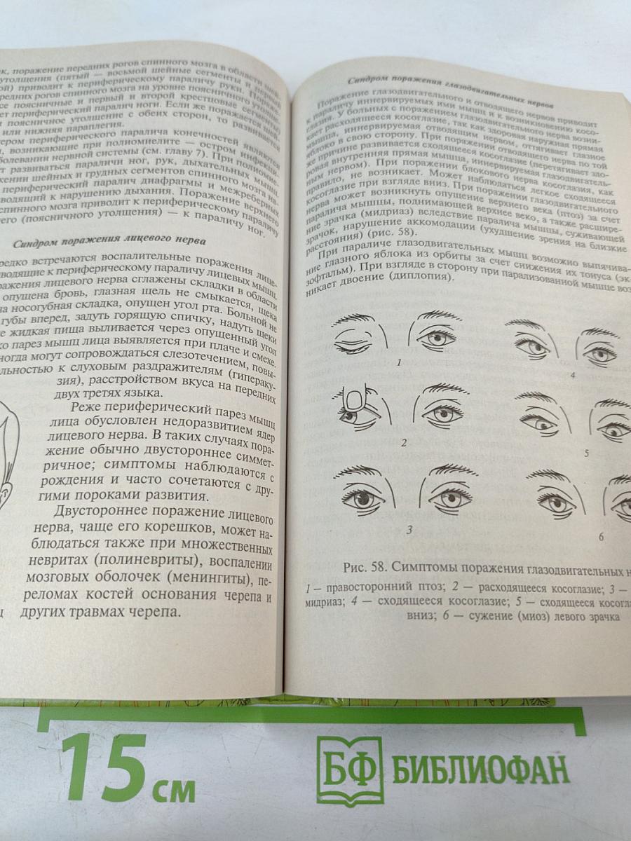 Невропатология