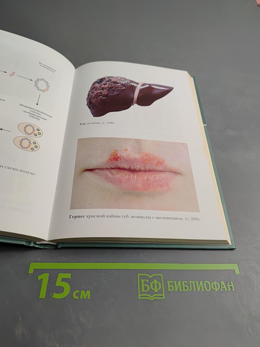 Большая медицинская энциклопедия. Том 3: ВНУ - ГИД