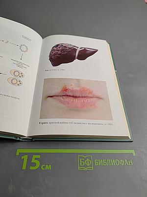 Большая медицинская энциклопедия. Том 3: ВНУ - ГИД