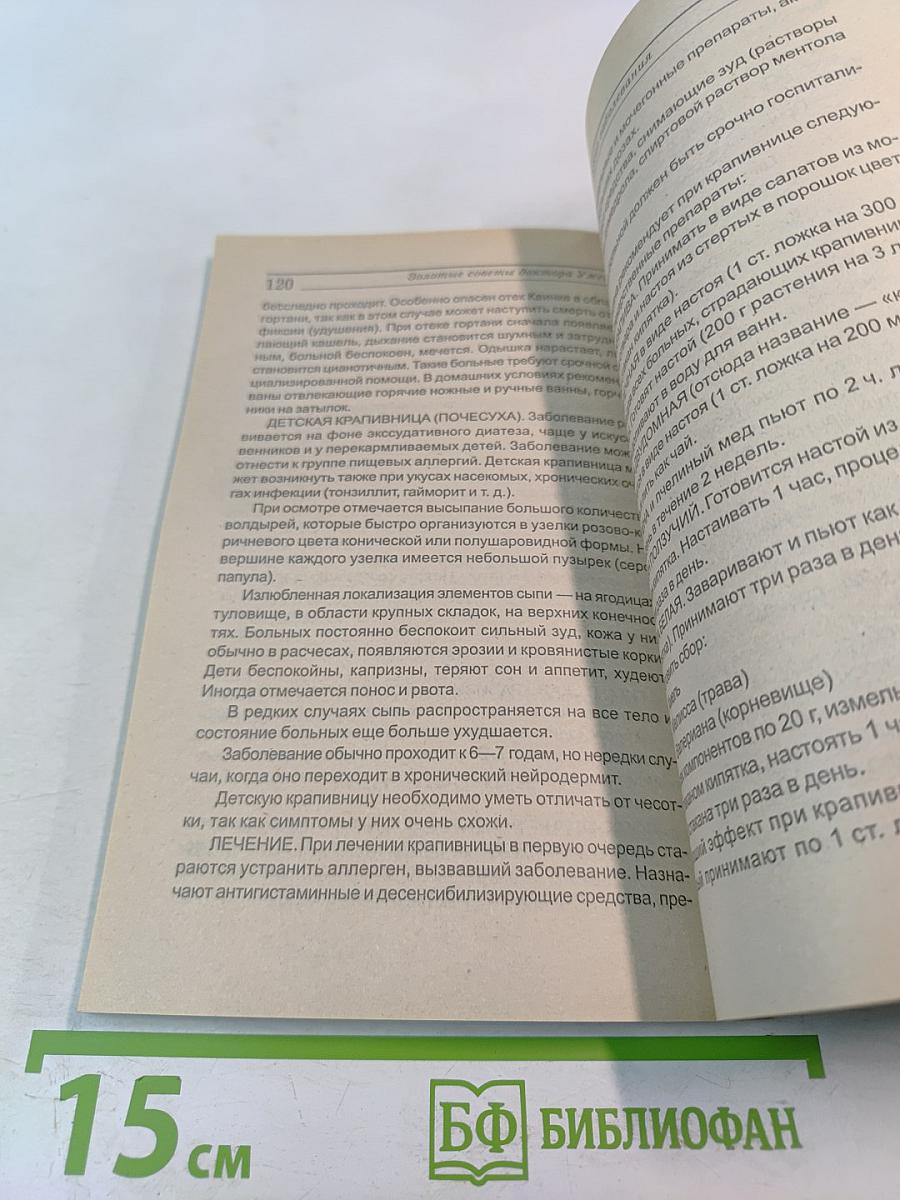 Аллергия и аллергические заболевания