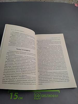 Геморрой. Лучшие методы лечения и профилактики