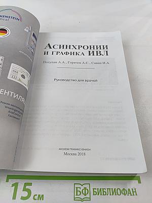 Асинхронии и графика ИВЛ. Руководство для врачей