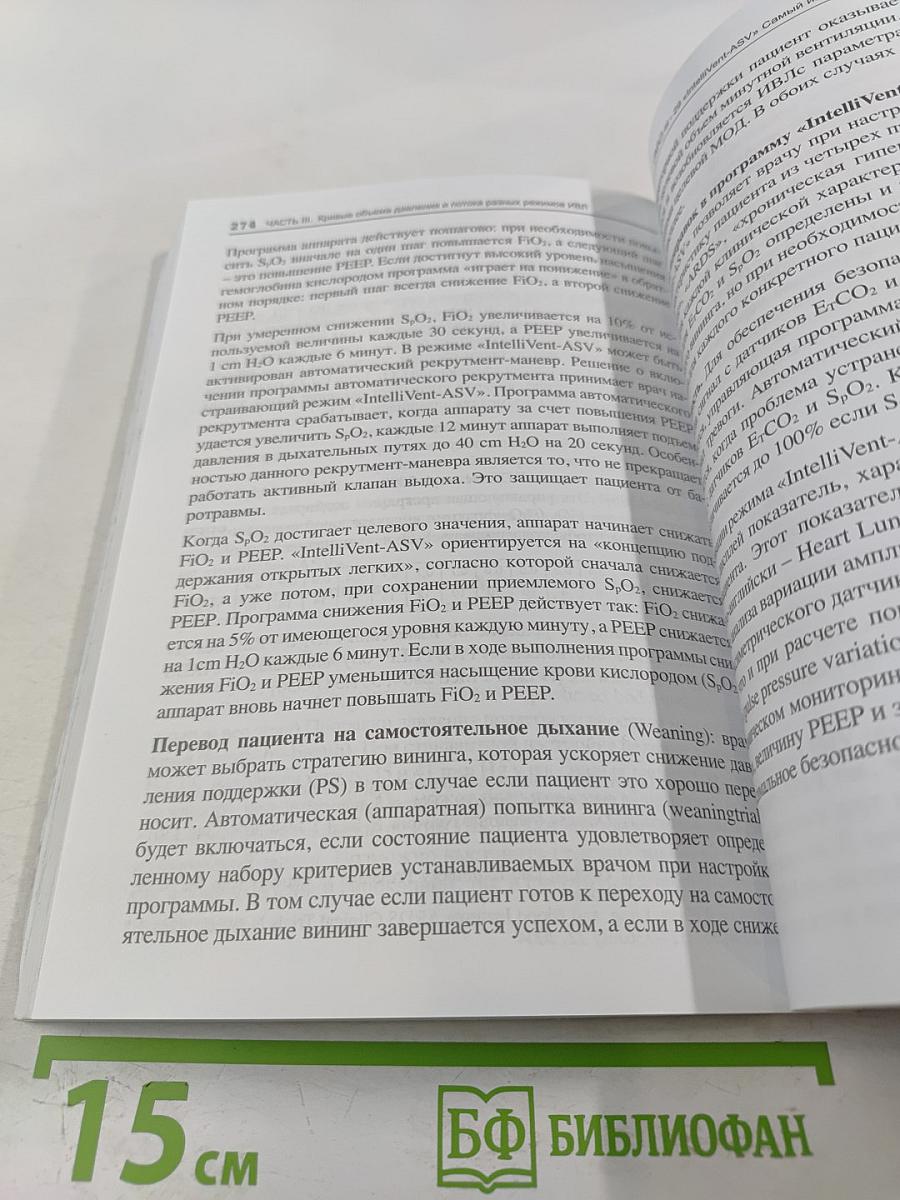 Асинхронии и графика ИВЛ. Руководство для врачей